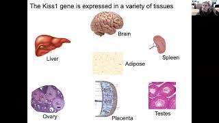 Pediatric Grand Rounds: “The Missing Link Between Puberty, Reproduction, and Metabolism”