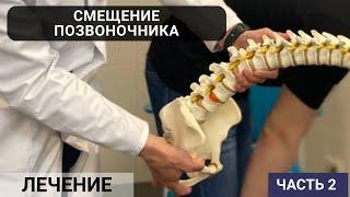 КАК ЛЕЧИТЬ СМЕЩЕНИЕ ПОЗВОНОЧНИКА? СПОНДИЛОЛИСТЕЗ (часть 2)