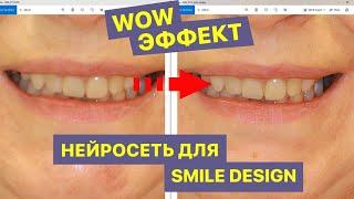 Применение нейросети, улучшающей качество фотографии для Exocad Smile Design