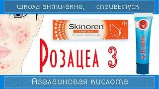 РОЗАЦЕА 3 | Азелаиновая кислота (Azelaic acid) СКИНОРЕН/АЗЕЛИК