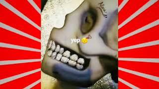 Xxxtentacion cake got diamond grillz