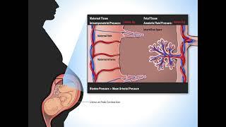 Uterine Contractions - Fundamentals of Fetal Health Surveillance