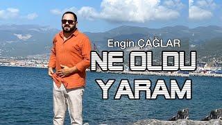 NE OLDU YARAM | Engin Çağlar