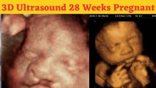 3d ultrasound 28 weeks pregnant | 28 weeks pregnant ultrasound | fetal development by week