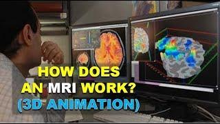 MRI SCAN (MAGNETIC RESONANCE IMAGING): WHAT IT IS? (BETTER EXPLAINED!!)