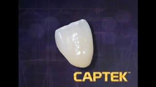 Captek™ Crowns & Bridges