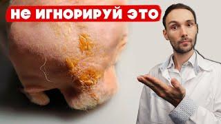 Здоровая кожа у морской свинки за 5 минут! Очиститка сальной железы у морской свинки