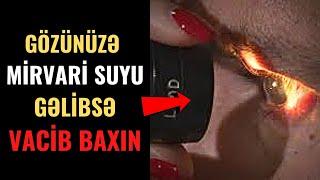 MÜTLƏQ BAXMALISIZ! - Gözünüzə Mirvari Suyu gəlibsə...