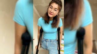 Tall Hip Amputee Girl Checking Her Jeans after Leg Cut off | Amputada