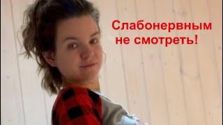 Слабонервным не смотреть! Как я делаю массаж живота после кесарева сечения.