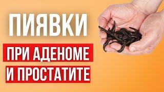 Пиявки при простатите и аденоме.