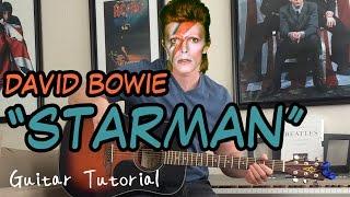 David Bowie - Starman - Guitar Lesson (INTRO, VERSE, CHORUS, OUTRO,  AND MORE!)