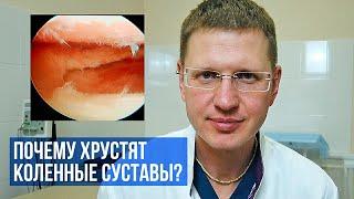 Почему хрустят коленные суставы? Как лечить?