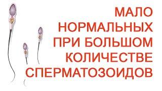 Мало нормальных при большом количестве сперматозоидов / Доктор Черепанов