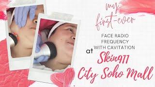 MY FIRST RF WITH CAVITATION EXPERIENCE AT SKIN911 CITY SOHO MALL| lifeisbeyeeutiful