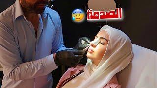 نتيجة عملية تجميل أنفي!! بكيت