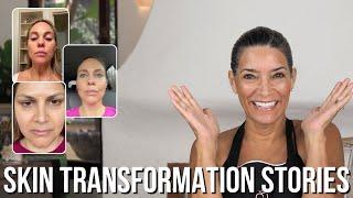 Anti Aging & NATURAL Skin Care Transformation!  | At Home Skin Care Success