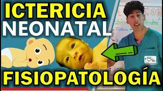 ICTERICIA NEONATAL FISIOPATOLOGÍA | GuiaMed