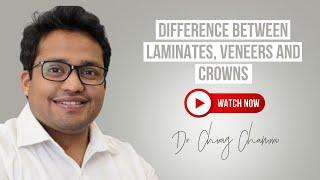 Laminates vs Veneers vs Crowns | Key Differences in Dental Restorations | Dr Chirag Chamria