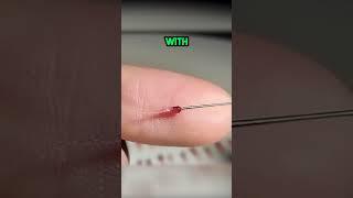 This is INSANE! Berry Surgery! 