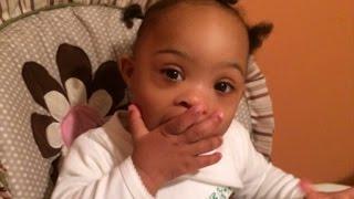 Toddler gets "bloodless" surgery