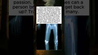 THE MAN MADE OF METAL