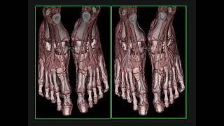 Cinematic Rendering: Principles, Pearls and Clinical Applications Part 1