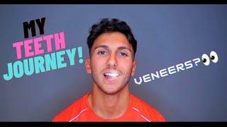 MY TEETH JOURNEY! | WHAT I'VE HAD DONE