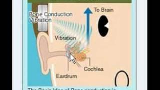 How Do The Audio Bone Headphones Work