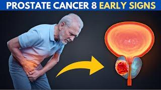 Don’t Miss These 8 Early PROSTATE CANCER Signs – They Could Save Your Life!