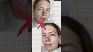 #УходЗаПроблемнойКожей #ЛетнийУход #ПроблемнаяКожаБезВысыпаний #ЛетоБезАкне