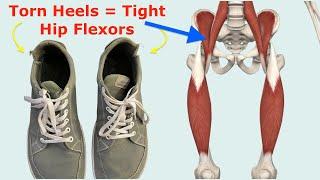 Don't Transition to Minimalist/Barefoot Shoes Until You Watch This (Hip Flexor Problems)