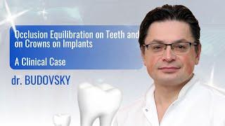 Occlusion Equilibration on Teeth and on Crowns on Implants