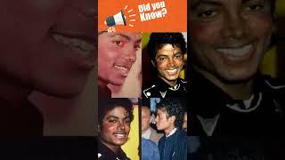 Michael Jackson: Lupus and Vitiligo