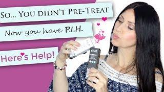 So... You have PIH!  | Chemical Peel Help | Dark Skin | Hyperpigmentation Treatment | Pretreatment