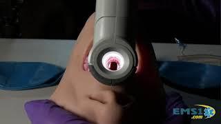 Vie-Scope: First Pass Intubation Success Rates that eclipse any Video-Laryngoscope