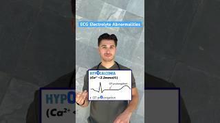 Easy trick for ECG Electrolyte Abnormalities  #medstudent #medschool #usmle #cardiology #ecg