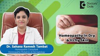 Dry & Itchy Skin | Best Homeopathic Medicine #skin  - Dr. Sahana Ramesh Tambat | Doctors' Circle