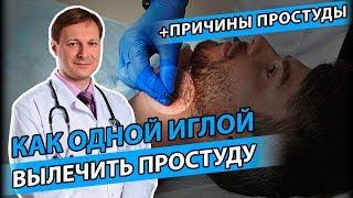 КАК ЛЕЧИТЬ ПРОСТУДУ? | Почему появляется простуда?