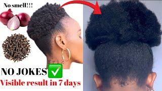 ONION JUICE WITH  NO SMELL‼️FOR HAIR GROWTH || Cloves and Onion For Unstoppable Hair Growth