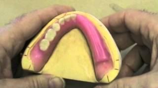 30 Setting Denture Teeth - Reference Lines