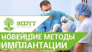 Современная имплантация зубов.  Узнайте об уникальных современных методах имплантации зубов!