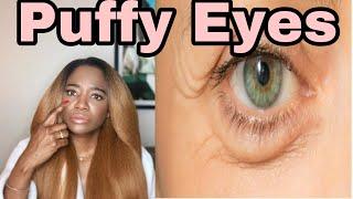 How To Get Rid Of Puffy Eyes | Scientist SEANKBEAUTY