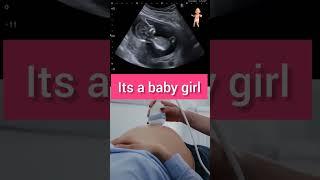 Ultrasound at 12 weeks of pregnancy #babygirl #ytshorts