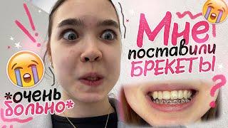 VLOG  Мне ПОСТАВИЛИ БРЕКЕТЫ *очень больно*