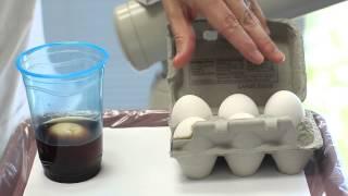 Teaching Kids About the Causes & Effects of Cavities : Dental Health