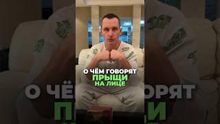 ДИАГНОСТИКА БОЛЕЗНЕЙ ПО ПРЫЩАМ НА ЛИЦЕ #здоровье #алексейкапустин #прыщи #альтернативнаямедицина
