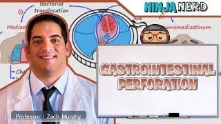 Gastrointestinal Perforation | Clinical Medicine