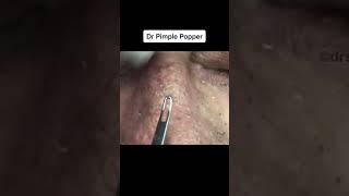 Nose Blackheads To Start Your Weekend #shorts