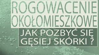 Rogowacenie okołomieszkowe